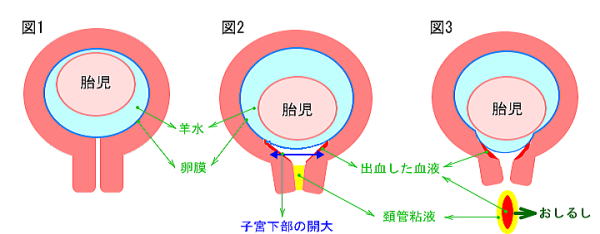 子宮 口 開く まで