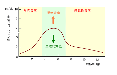 母乳 性 黄疸 と は